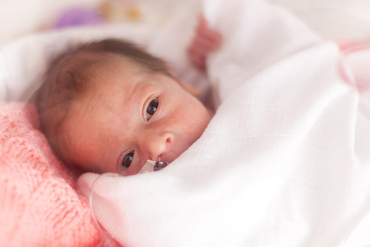 Premature babies may have weak Moro reflex