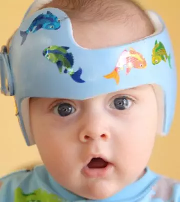Why Do Babies Have To Wear A Helmet And For How Long?