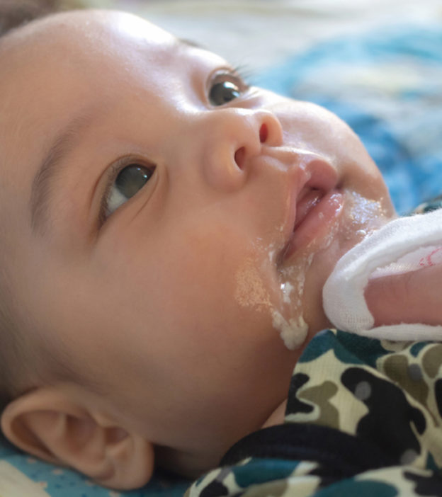 Baby Spitting Up Curdled Milk: What’s Normal, Causes And Treatment