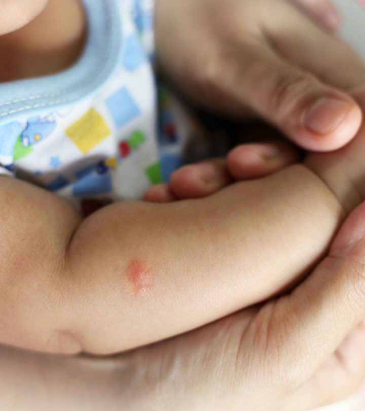 Flea Bites On Babies: Pictures, Treatment And Prevention