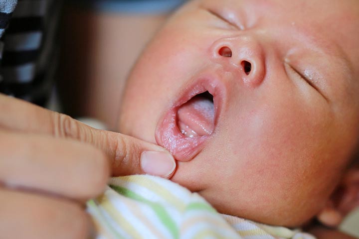婴儿的唇疱是什么样的