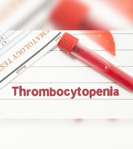 Neonatal Thrombocytopenia: Causes, Symptoms And Treatment