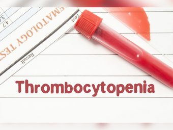 Neonatal Thrombocytopenia: Causes Symptoms And Treatment