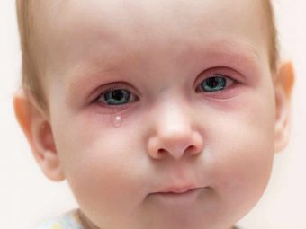 Pink Eye In Toddlers: Causes, Symptoms And Treatment