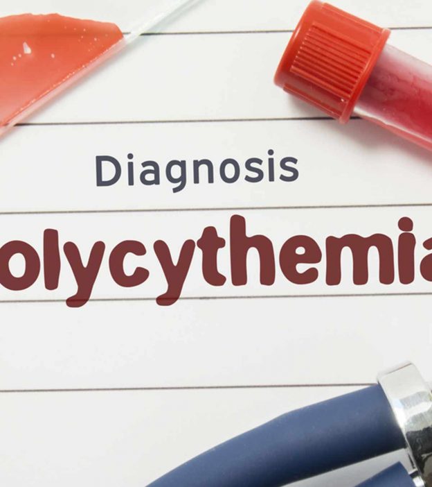 Polycythemia In Newborn: Causes, Symptoms And Treatment