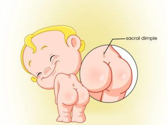 Sacral Dimples in Newborn Symptoms, Causes And Treatment