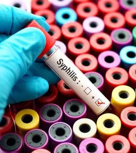 Syphilis In Babies: Symptoms, Diagnosis And Treatment