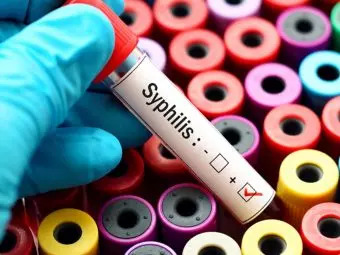 Syphilis In Babies: Symptoms, Diagnosis And Treatment