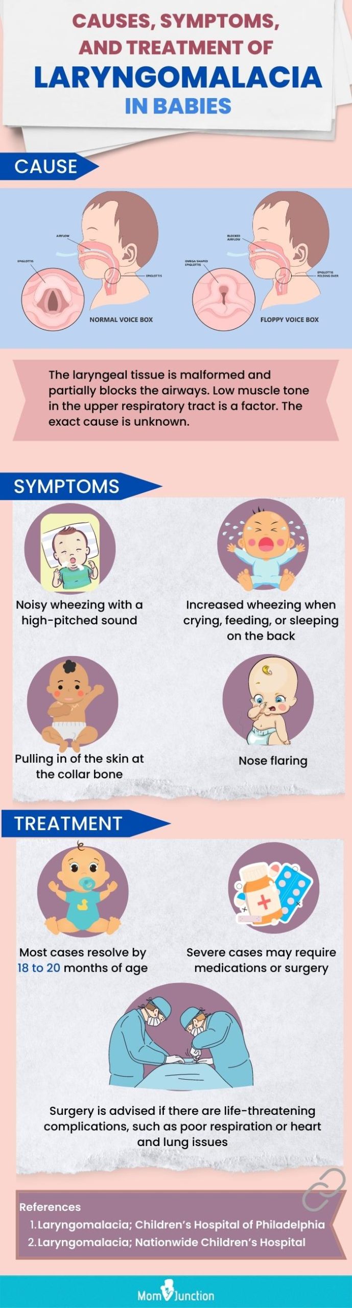 causes symptoms treatment of laryngomalacia in babies (infographic)