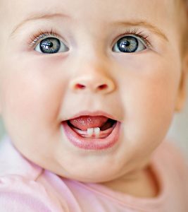 Crooked Teeth In Babies: Causes And Tips To Prevent It