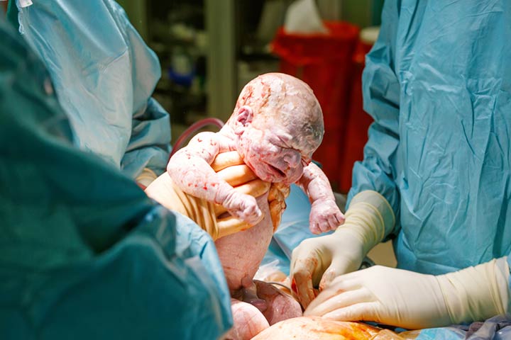 Do you know what will happen to your baby if you have a cesarean