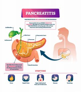 Pancreatitis In Children: Symptoms, Diagnosis & Treatment