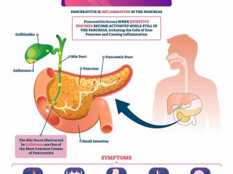 Pancreatitis In Children Causes, Symptoms, Diagnosis, And Treatment