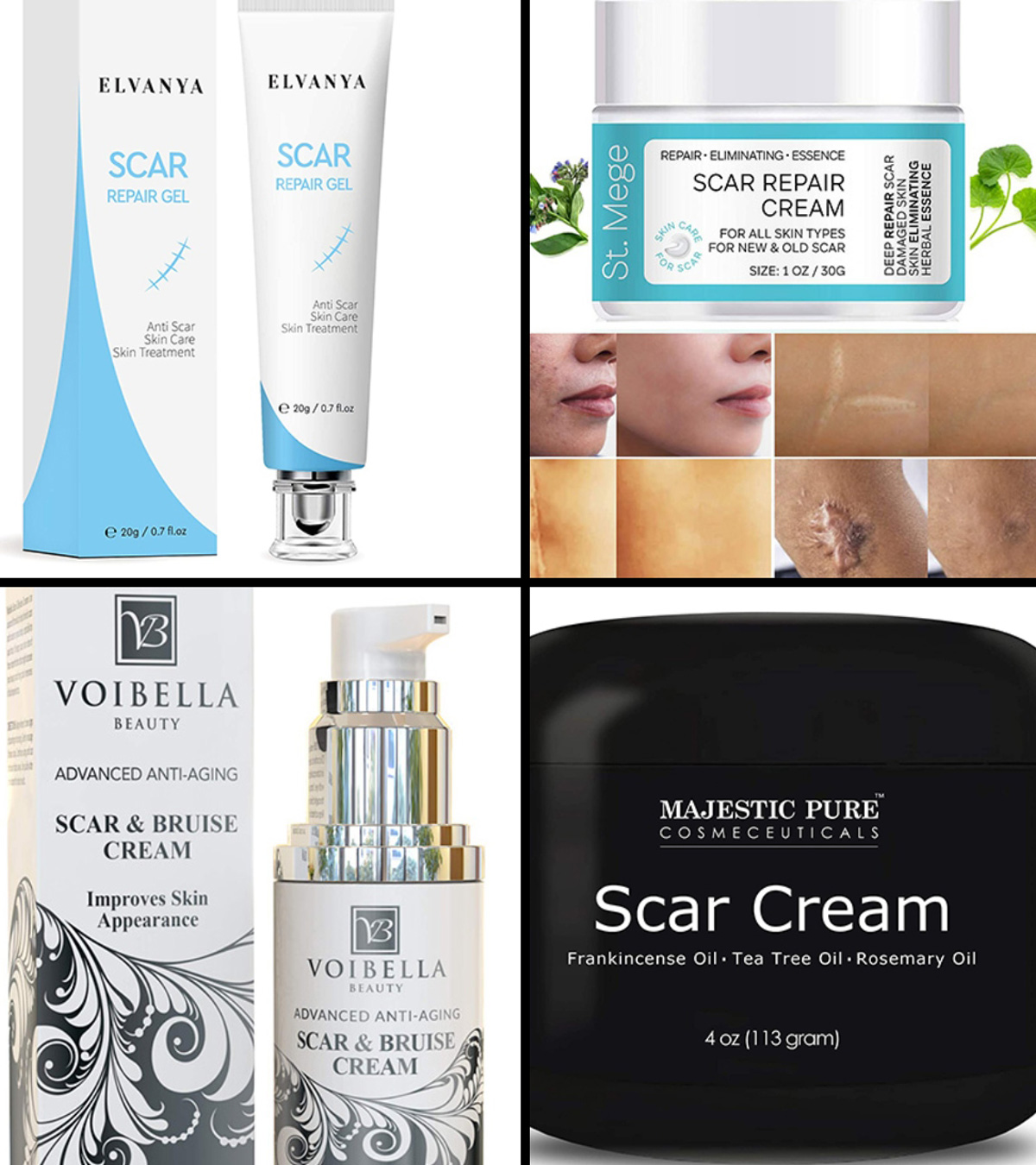 11 Best Scar Removal Creams For Your Skin In 2023