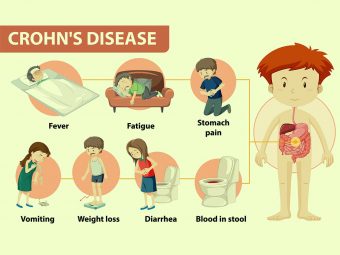 Crohn's Disease In Children: Causes, Symptoms, Diagnosis, And Treatment