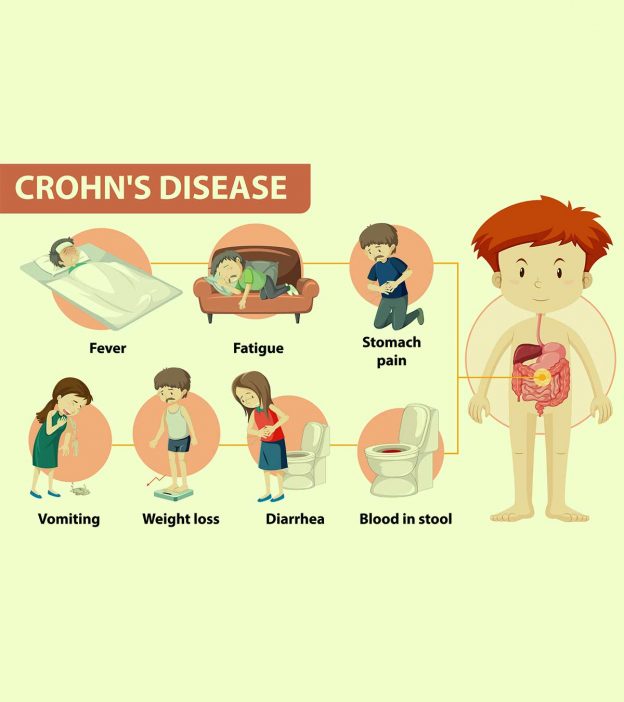 Crohn's Disease In Children: Symptoms, Causes And Treatment