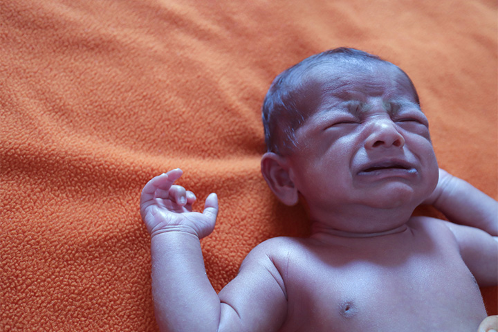 Baby Heat Rash: Types, Symptoms And Treatment