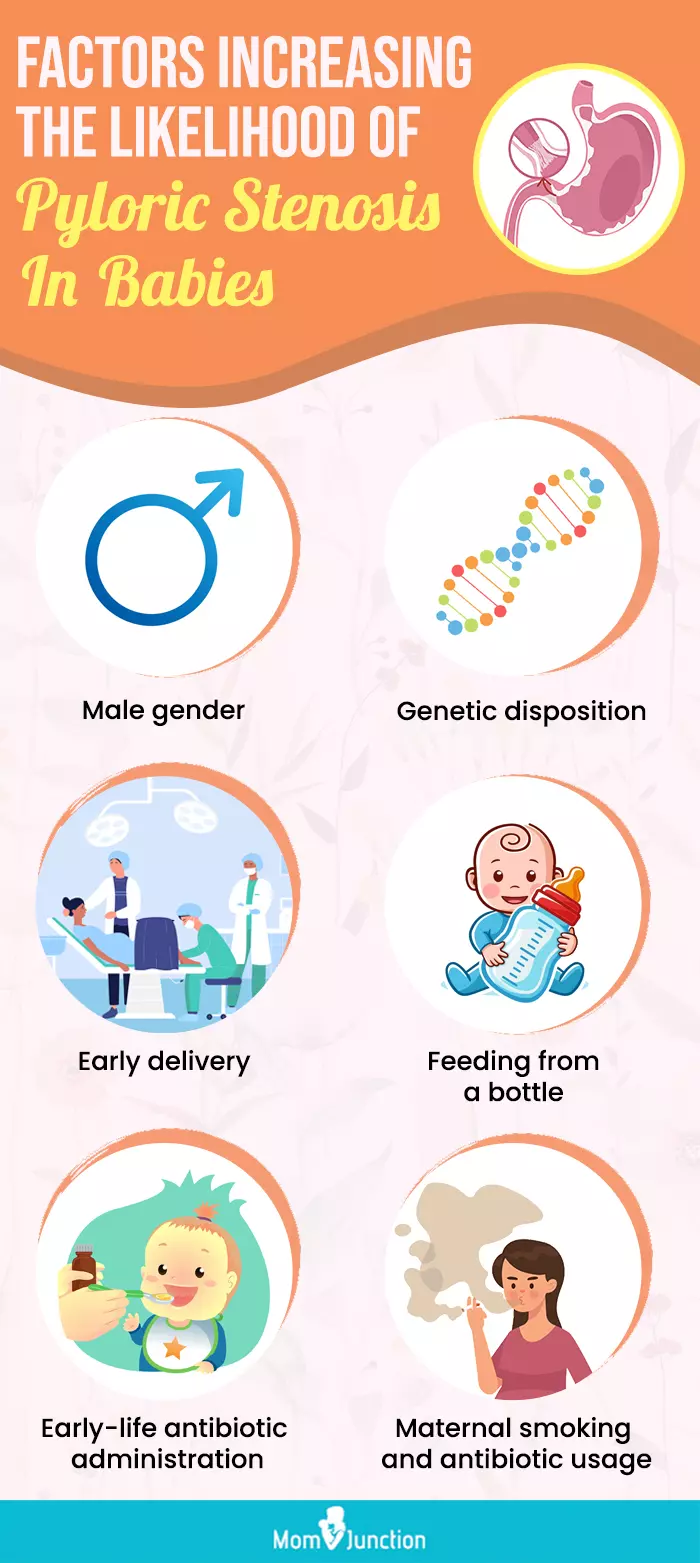 factors increasing the likelihood of pyloric stenosis in babies (infographic)