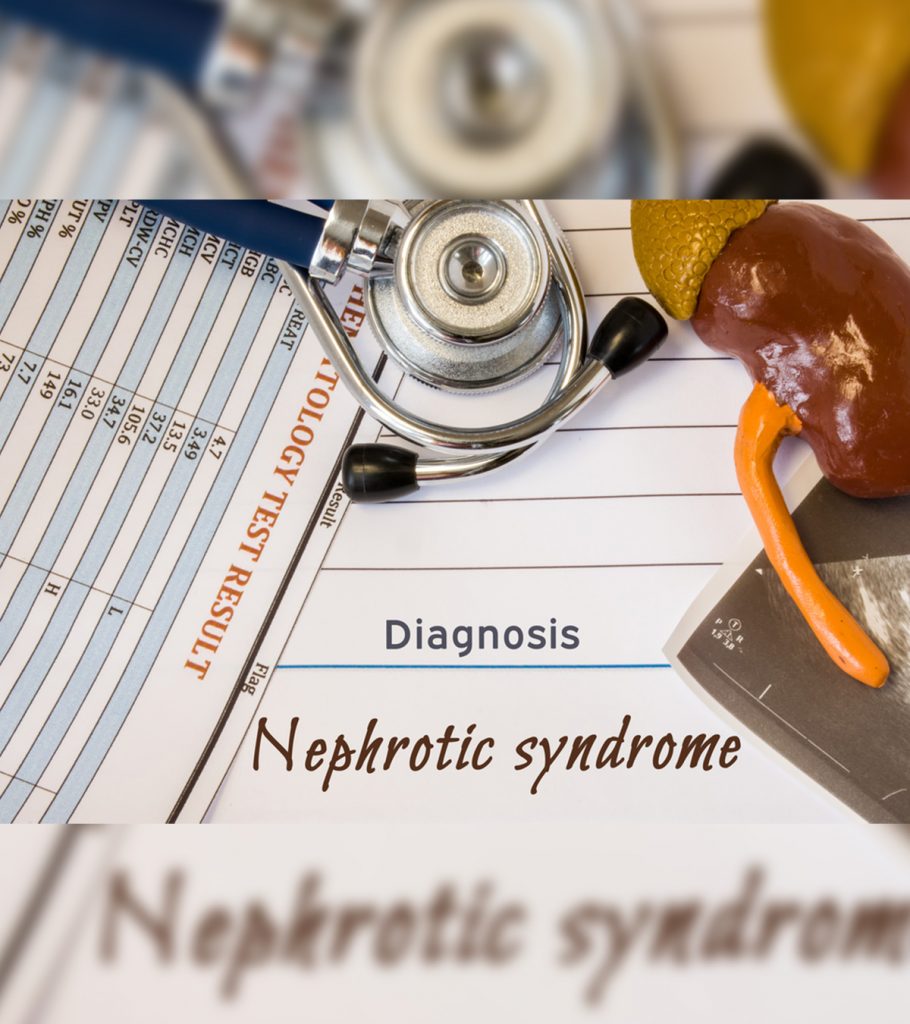 Nephrotic Syndrome in Children - Pictures