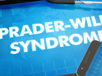 Prader Willi Syndrome: Causes, Symptoms, Diagnosis, And Treatment