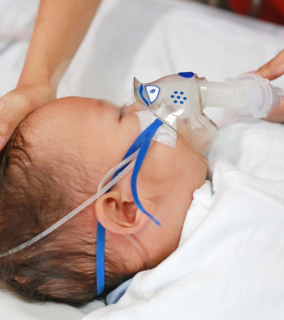 Respiratory Syncytial Virus RSV In Babies Symptoms TreatmentAndPrevention