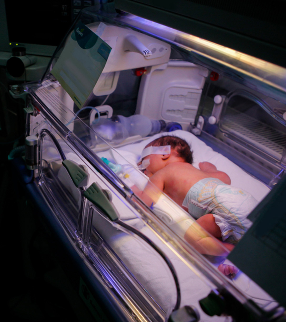 The Neonatal Intensive Care Unit (NICU): What To Expect