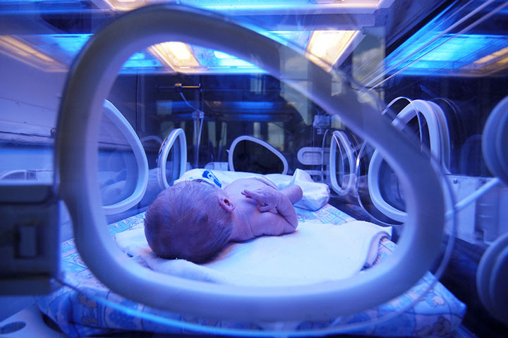 What Is The Neonatal Intensive Care Unit