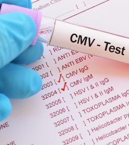 Cytomegalovirus (CMV) In Babies: Symptoms & Causes