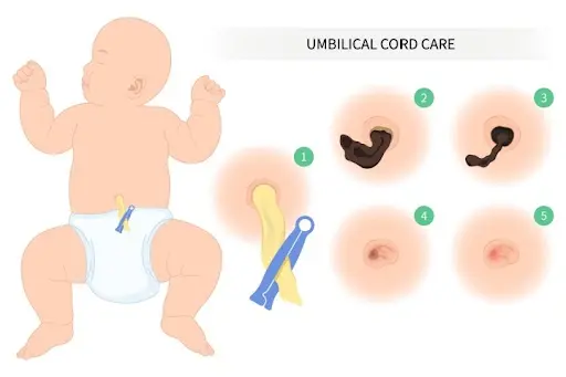 Healing process of umbilical cord