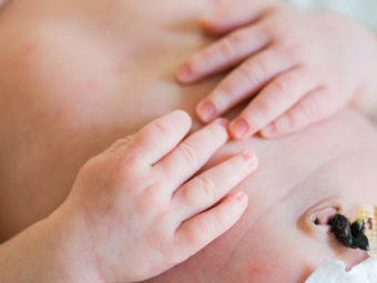 Newborn Belly Button Bleeding: What’s Normal And When To Worry