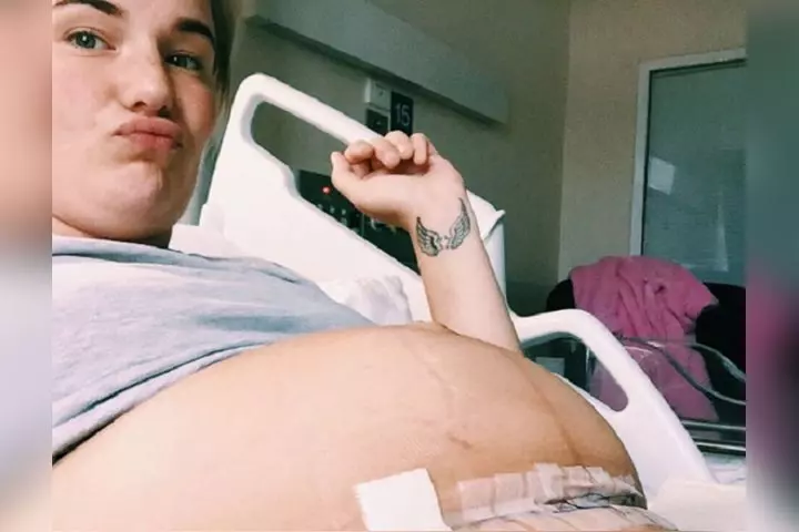Shows a 6 inch incision
