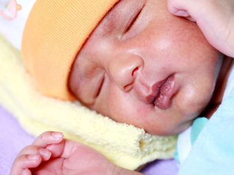 नवजात शिशुओं और बच्चों में त्वचा संबंधी रोग (स्किन एलर्जी) | Bacho Ki Skin Allergy