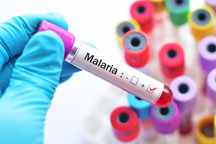 Blood tests help in the diagnosis of malaria