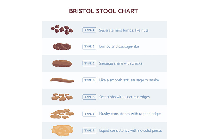Briston stool-scale for baby poop color
