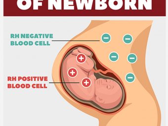 Hemolytic Disease of the Newborn: Symptoms, Risks & Treatment