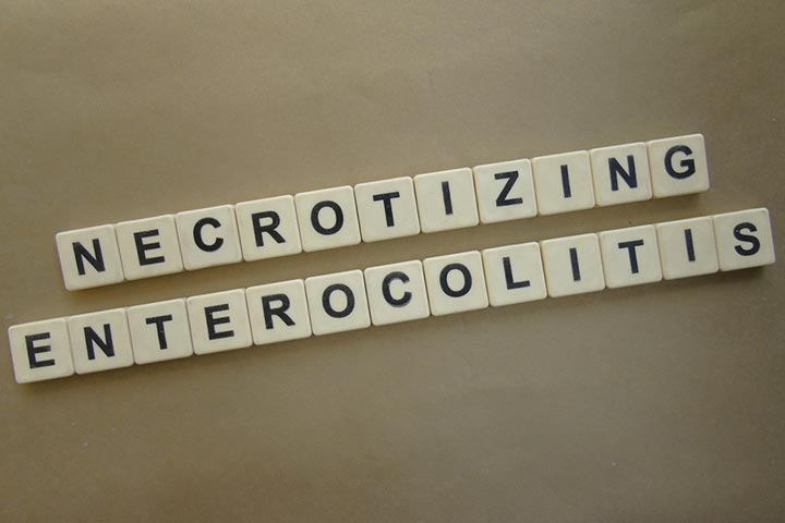 Necrotizing Enterocolitis NEC In Newborns Symptoms, Causes And Treatment-1