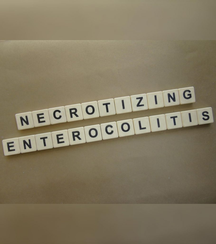 Necrotizing Enterocolitis NEC In Newborns Symptoms Causes And Treatment
