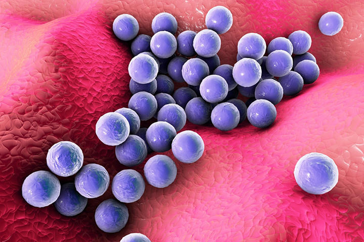 Staphylococcus aureus bacterium can cause the infection