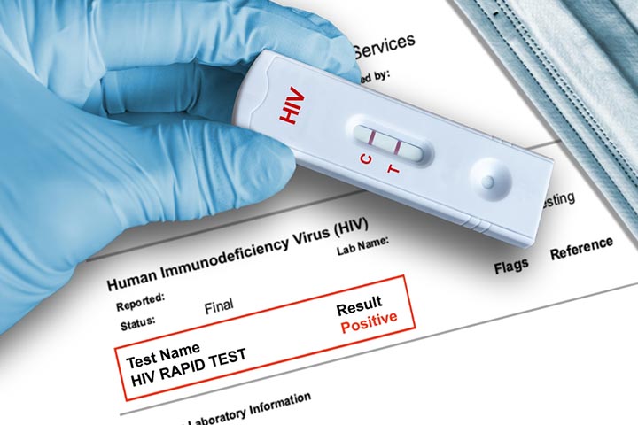 Virological testing is essential to confirm the diagnosis of HIV in babies