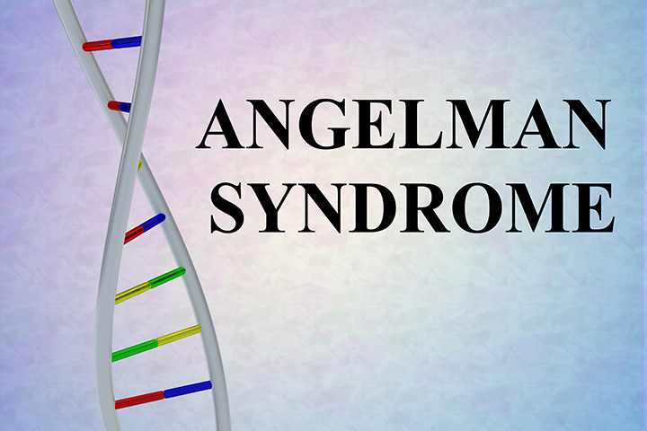 What Is Angelman Syndrome Causes, Symptoms And Treatment