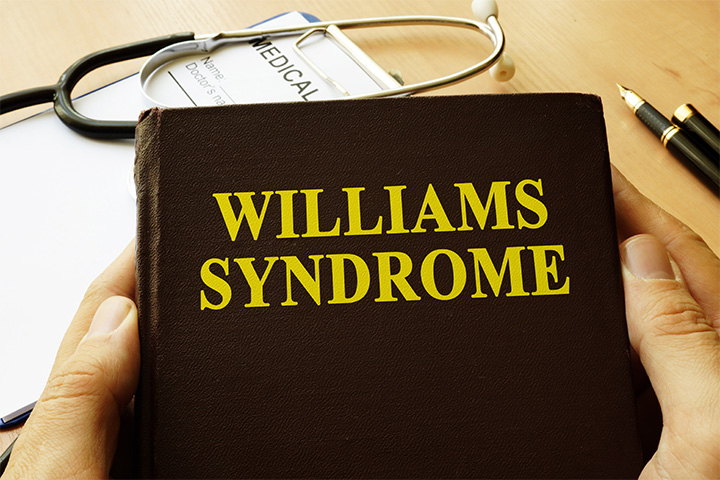  Williams Syndrome In Babies Symptoms, Causes, And Treatment