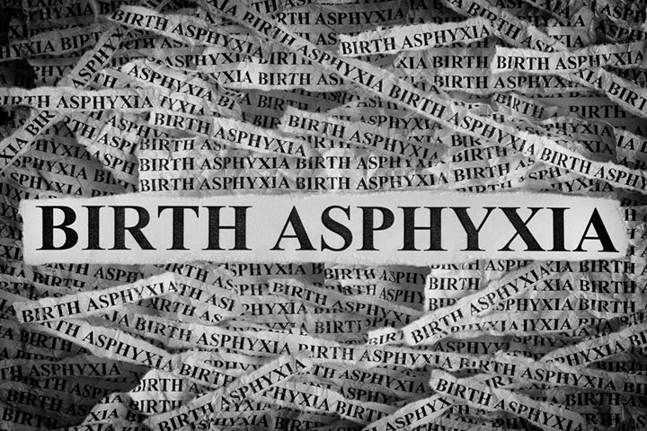 Birth Asphyxia Symptoms, Causes And Treatment