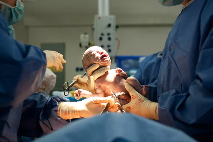 During A C-Section