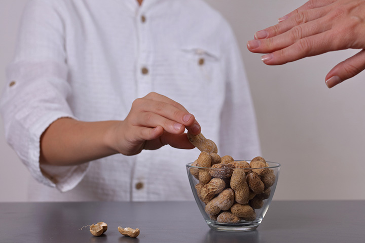 Food Allergies In Children Causes, Symptoms, Treatment And Prevention