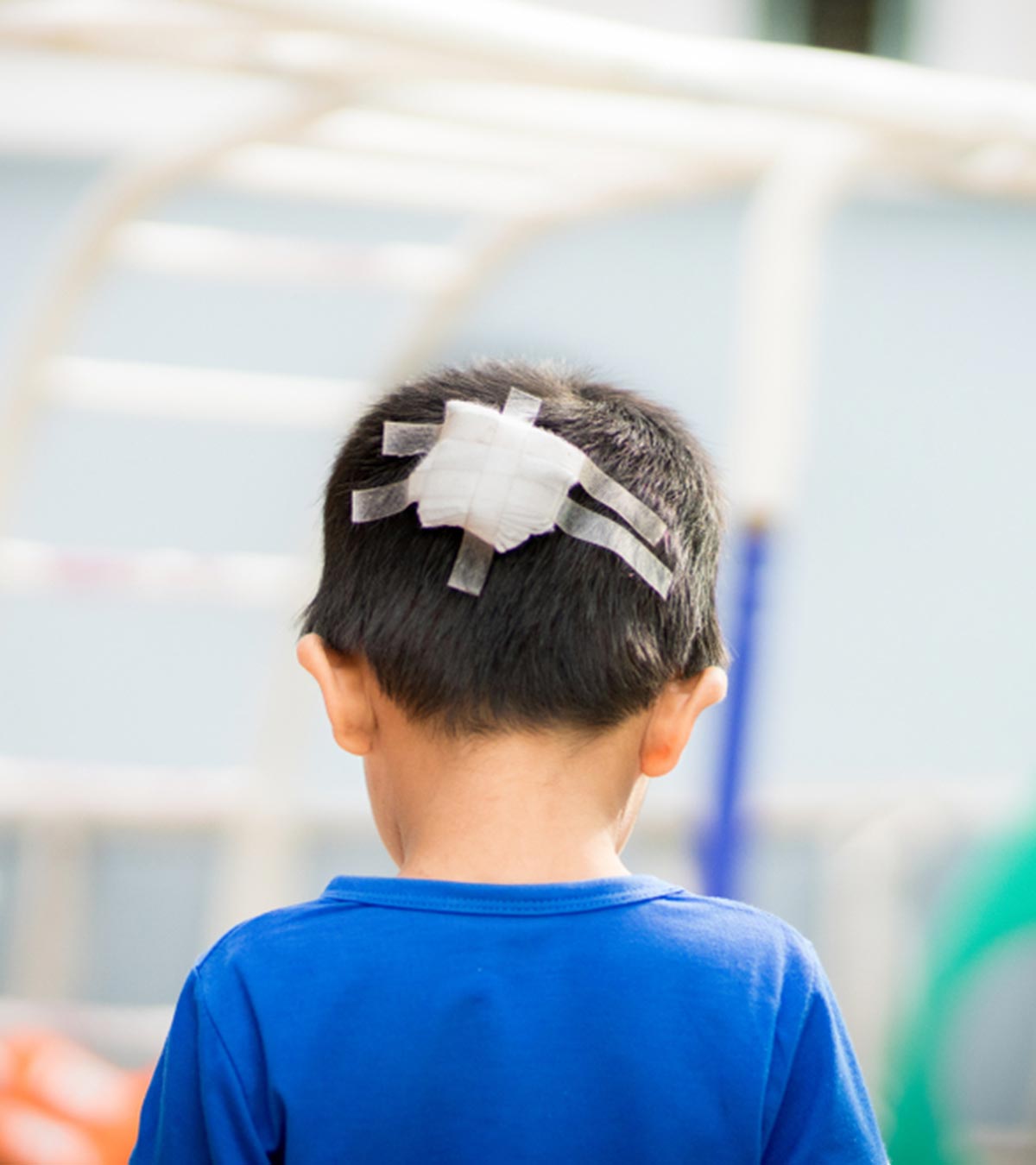 बच्चों के सिर में चोट लगना: प्रकार, कारण, इलाज व जटिलताएं | Head Injury in Children in Hindi