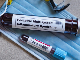 Multisystem Inflammatory Syndrome (MIS-C) In Children