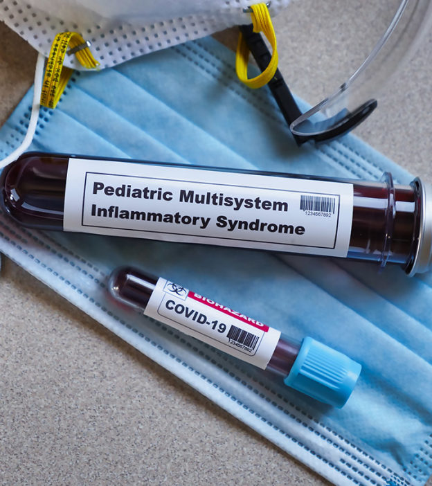 Multisystem Inflammatory Syndrome In Children & Complications