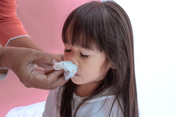 Nasal sprays for kids may cause nosebleeds