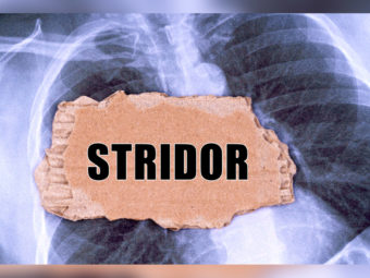 Stridor In Children: Diagnosis, Complications And Treatment