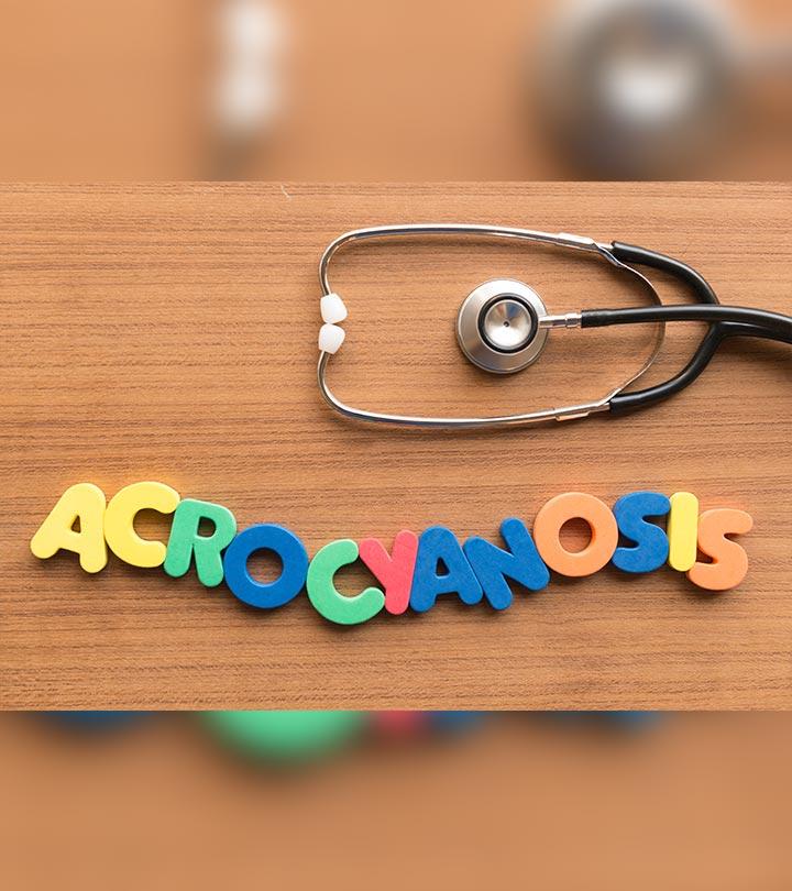 Acrocyanosis In Newborn: Causes, Symptoms, Diagnosis And Treatment